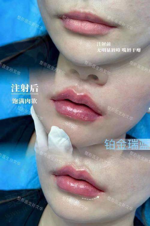 五、求美者的评价与实例