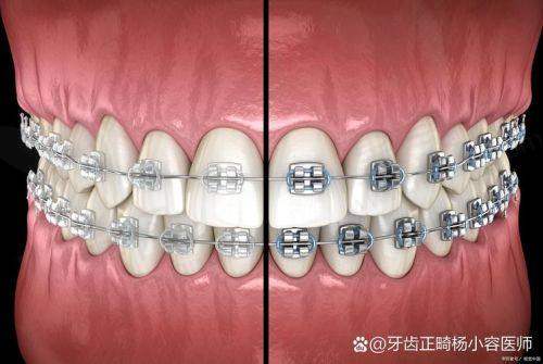 实际实例：成功的矫正故事
