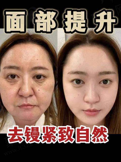 一、张林宏医生与西安高一生医疗美容医院概述