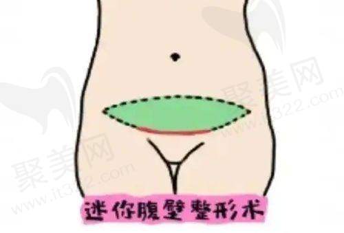 唐勇医生的擅长领域：多元技艺涵盖私密整形