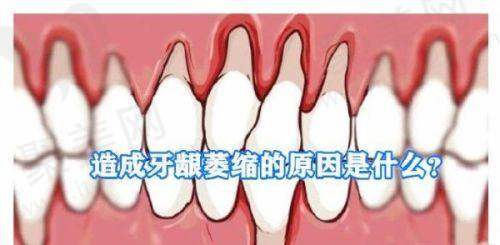 广州德伦口腔是三甲吗？连锁的口腔专科非三甲技术强、医生优、口碑好