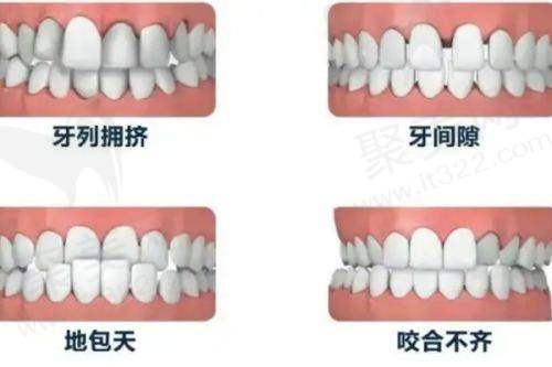 小孩矫正牙齿：替牙期问题的合适矫正时间
