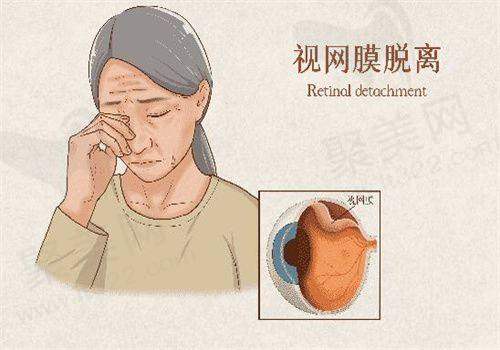 毕节威宁视康眼科医院地址电话：