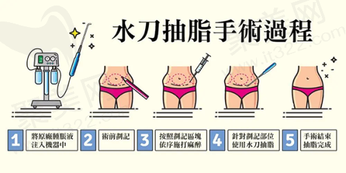 其他项目价格情况