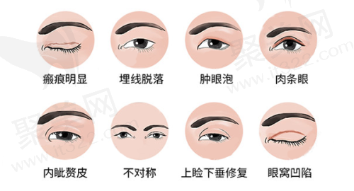 成都素美医疗美容许智开内眼角价格1888元起，精细定制恢复快开启美眼之旅
