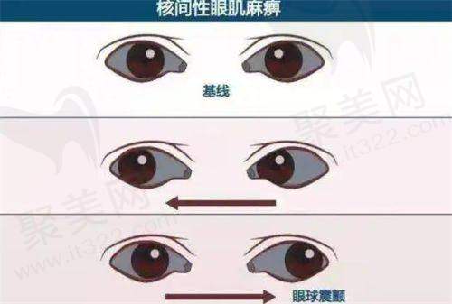 毕节威宁视康眼科医院正规吗？