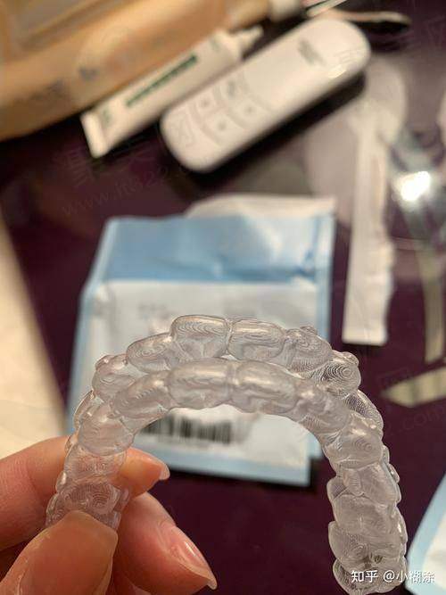 在广州德伦口腔做时代天使隐形矫正的流程是怎样的？