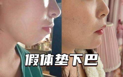 成都素美医疗美容医院靠谱吗？