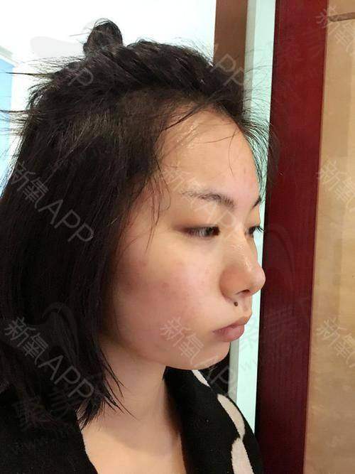 成都素美卢元刚医生实力如何？