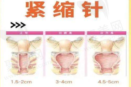 王栋医生预约方式