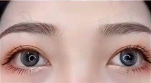 成都李瑞萱的精细缝合技术有什么优势