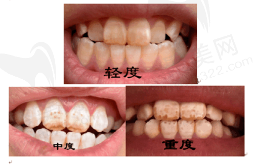 扬州浦美口腔门诊部技术好不好？