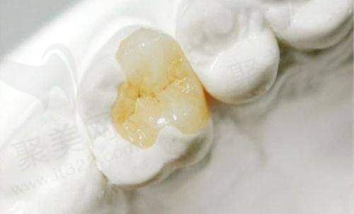 河源好佰年口腔简介及选择该医院的理由