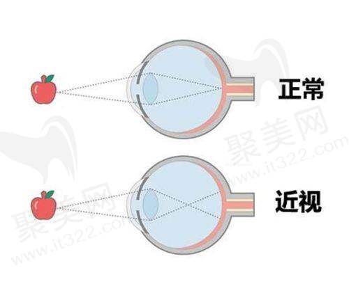 福州麦迪格视光眼科诊所技术好不好？
