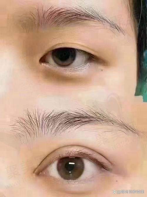 总结文辉才医生的魅力与实力