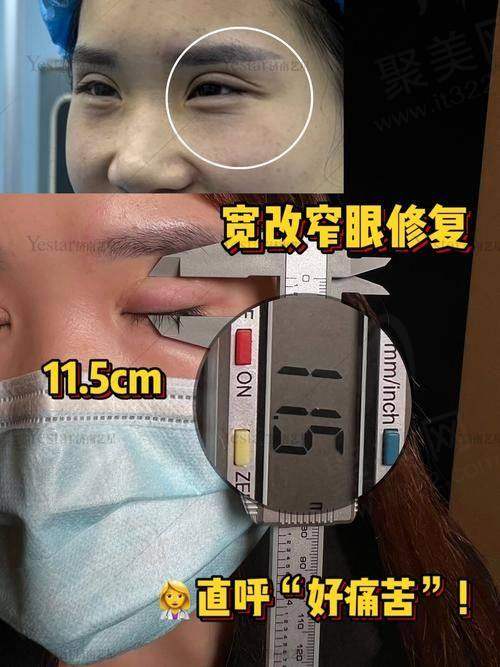 长沙张姣姣医生的声誉：行业口碑与反馈