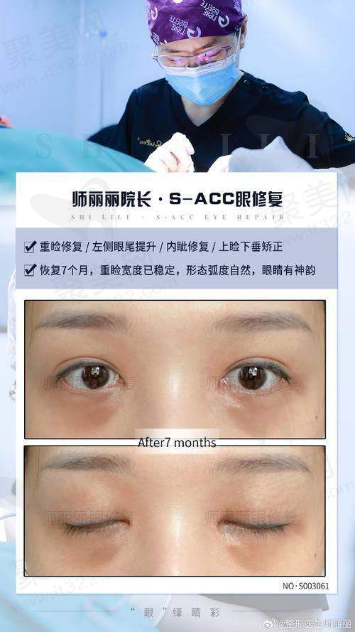 冯显雅医生坐诊北京印正山医疗美容，双眼皮修复技术优异，电话预约方便快捷！