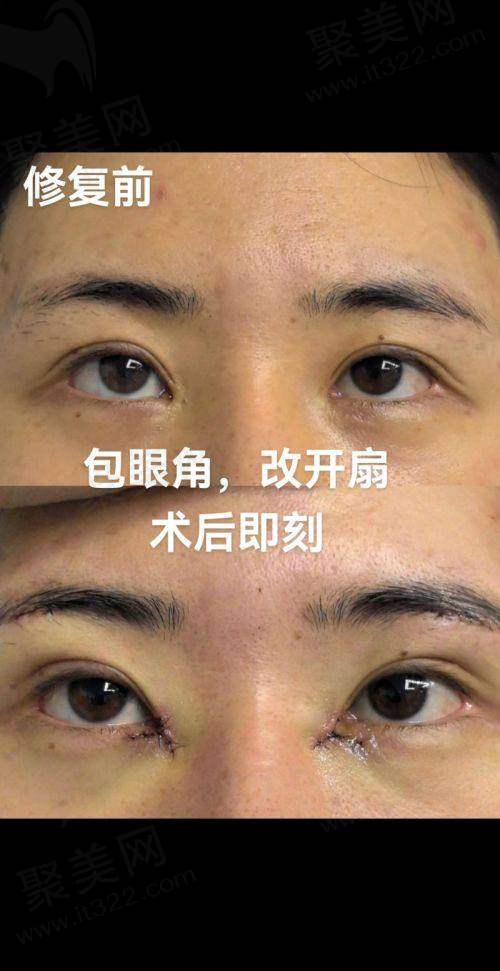 长沙张姣姣医生：患者真实实例分享