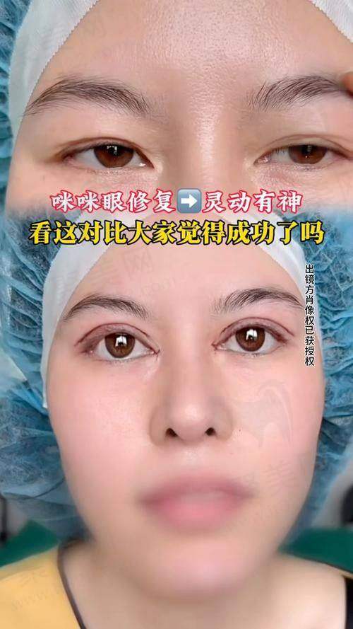 印正山整形怎么样？患者口碑反馈