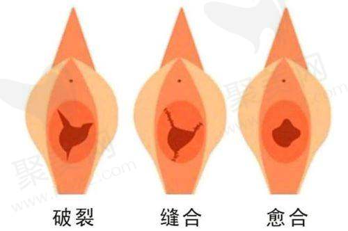 李峰永医生的真实的患者评价如下：