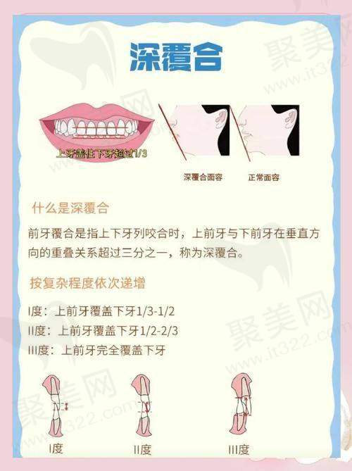 深覆合一度：轻度概述与症状