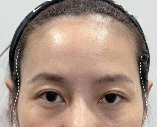 上海薇琳李花停擅长哪些项目？