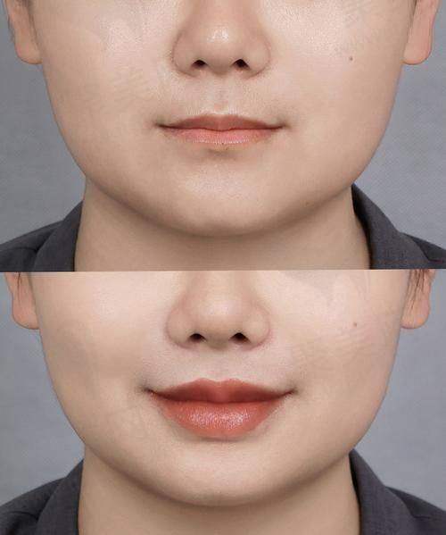 上海薇琳李花停的收费价格贵吗？