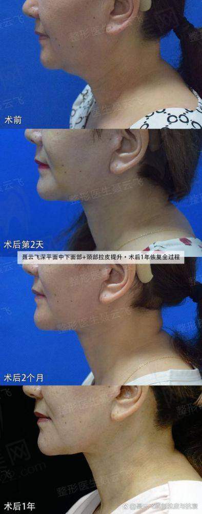 刘文阁医生的预约方式与就诊流程