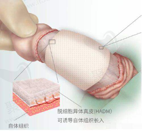 成都素美杨迪医生擅长眼部整形