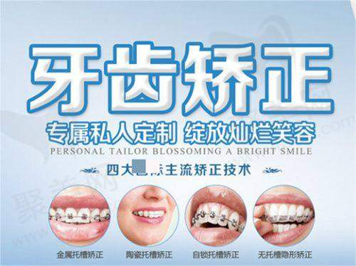 普特五代自锁托槽价格详细介绍