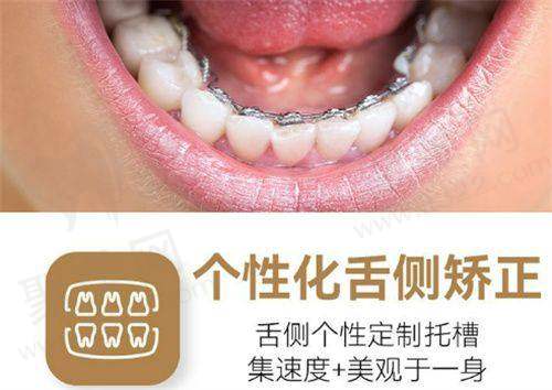 总结：普特五代自锁托槽价格与选择的综合考量