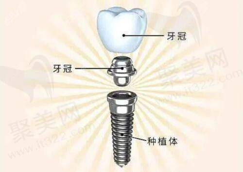 南京市口腔医院牙齿矫正项目费用介绍