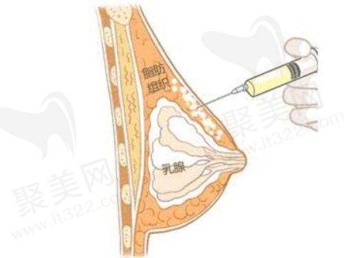 成都素美杨迪医生擅长眼部修复
