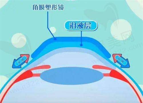 杭州朝聚眼科医院是公立还是私立医院？连锁规模大服务全收费亲民值得选