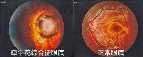 杭州朝聚眼科医院白内障手术收费价目表包含哪些内容？