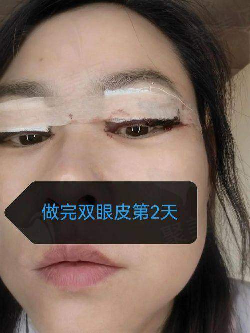 眼部修复技术，解决疑难问题