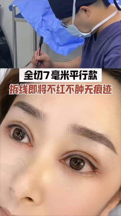 专注眼周手术，“专而精”的稀缺定位