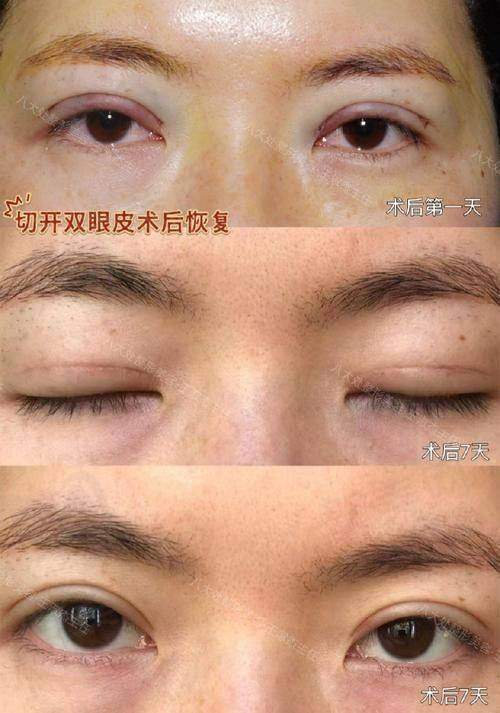 综上所述，北京嘉禾的孙景波医生凭借其深厚的专精资质与经验、专注眼周手术的“专而精”定位、高超的手术技艺、良好的荣誉与口碑、合理的收费与高性价比以及便捷的预约方式，属于中高端档次的眼整形医生。他在北京医美市场中具有较高的有名度和影响力，是众多爱美人士信赖的眼整形骨干医生。如果您也有眼整形方面的需求，不妨询问孙景波医生，让他为您打造一双美丽的眼睛。