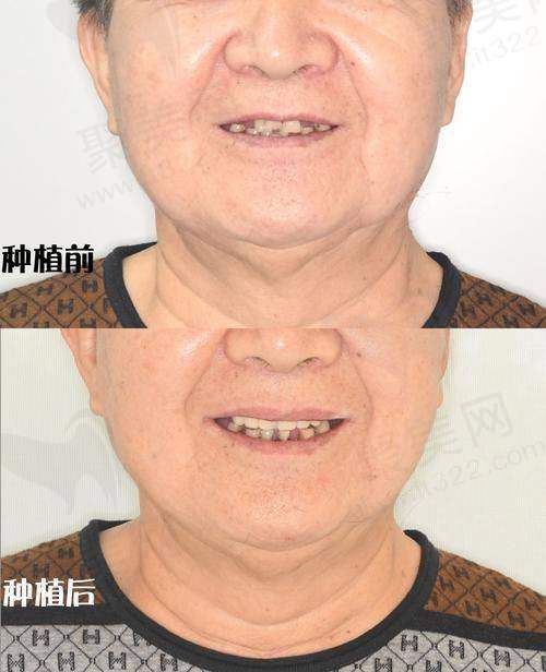 成都医大口腔医院本身实力怎么样？