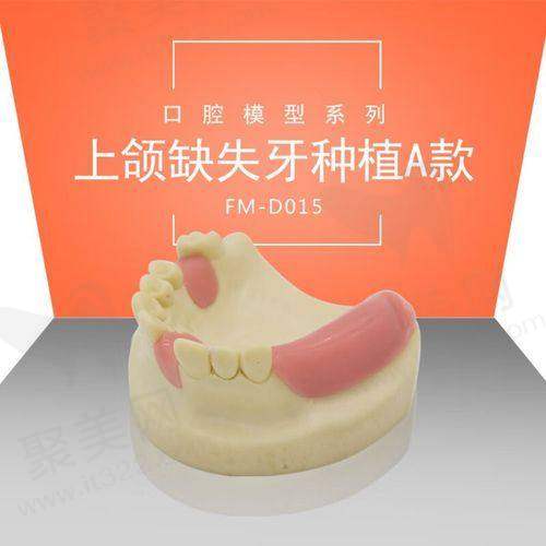 瑞典诺贝PMC种植牙有什么特性和优势？