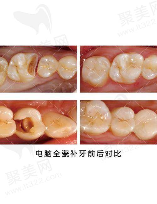 日本F00：性能灵活与经济适用