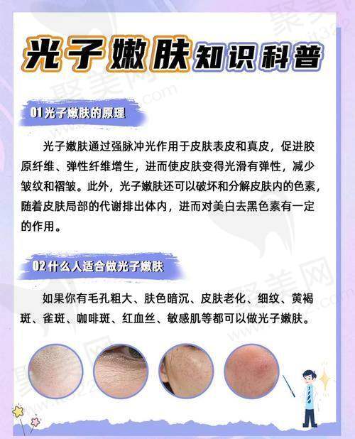 成都友谊整形M22光子嫩肤全模式有什么技术优势？