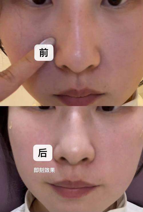 深圳阳光童晓钦医生的优势