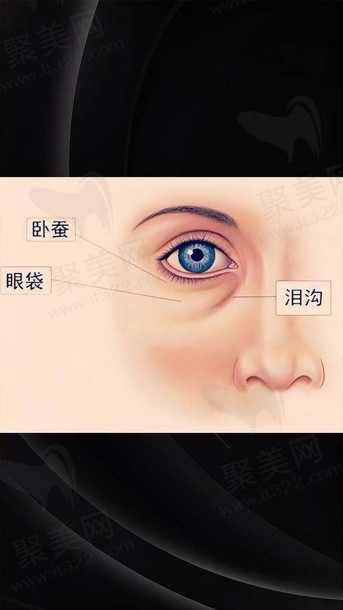 深圳阳光童晓钦弗缦胶原填泪沟的价格