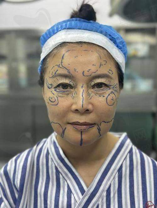 口碑评价：患者与网友的双重认可
