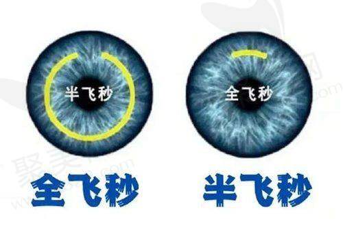 北京至亮眼科离焦镜的价格优势