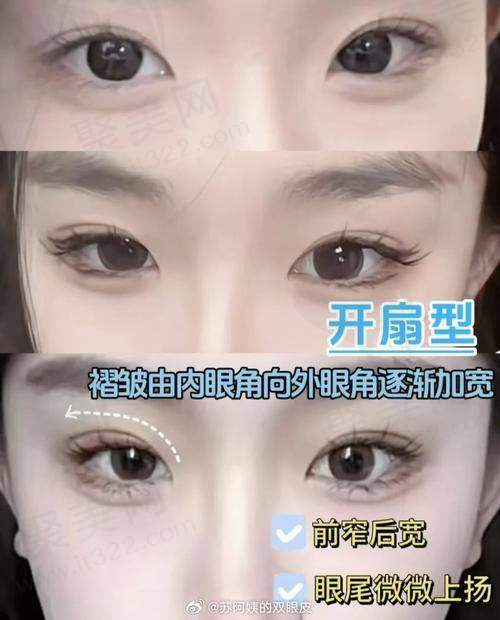 五、总结
