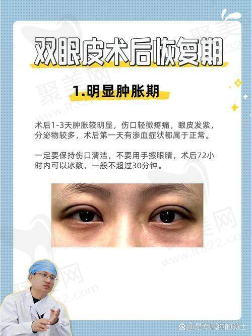三、上海李营医生双眼皮口碑评价