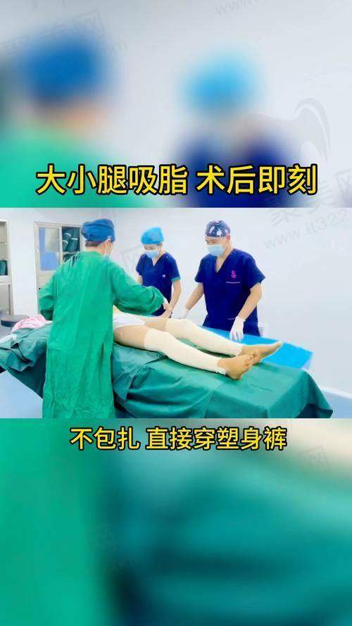深圳阳光整形医院吸脂技术和医生怎么样？