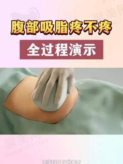 大连沙医生整形腰腹环吸技术优势